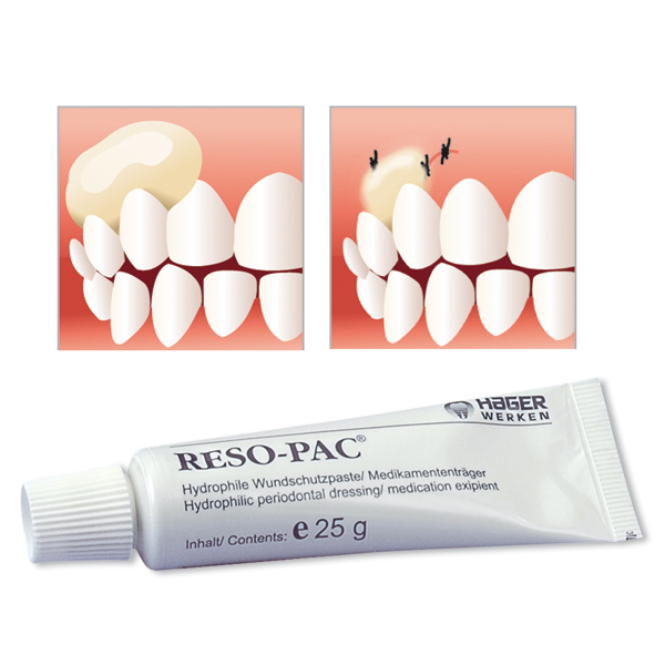 Reso-Pac cаморассасывающаяся повязка для изоляции ран и стабилизации швов в полости рта, юнидозы (50 шт. х 2 г.)